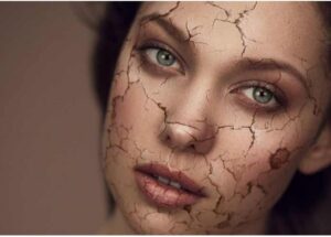 ویژگی انواع پوست را بنویسید