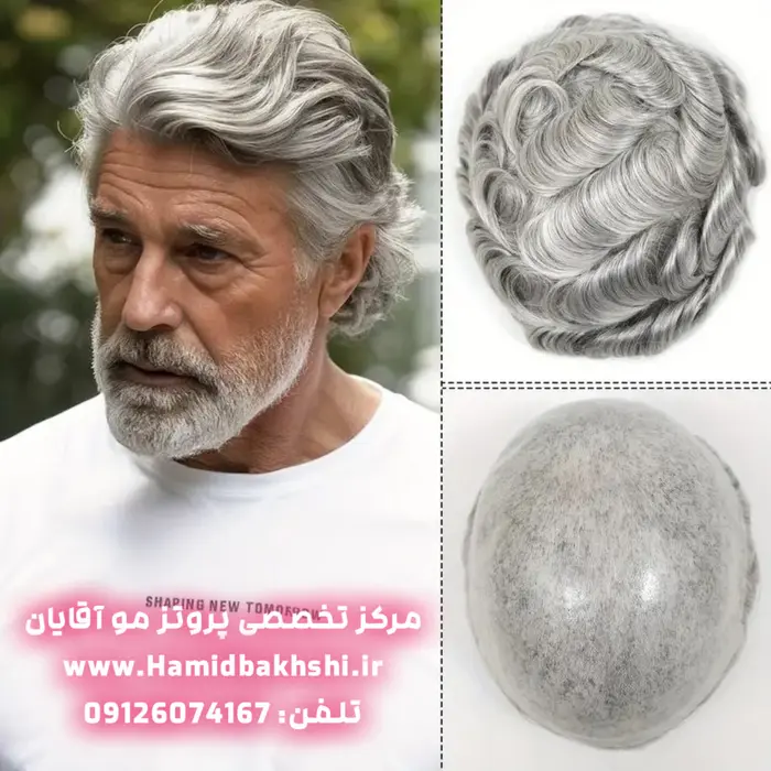 هزینه پروتز مو آقایان چقدره؟