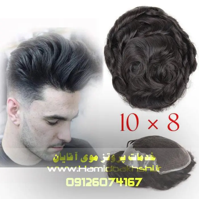 هزینه پروتز مو آقایان