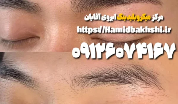 هزینه میکروبلیدینگ ابروی آقایان