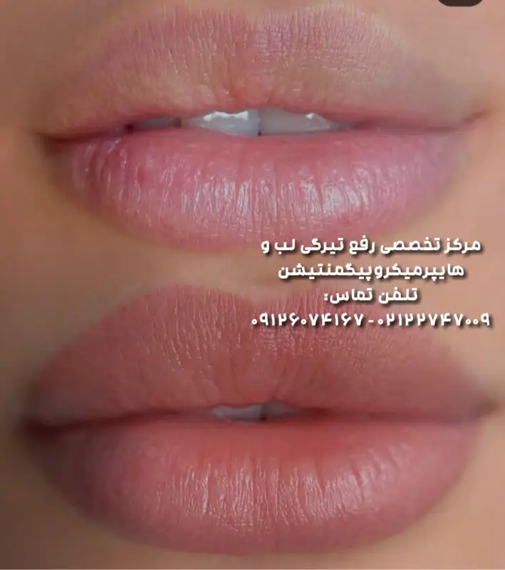 احیا رنگ لب در تهران