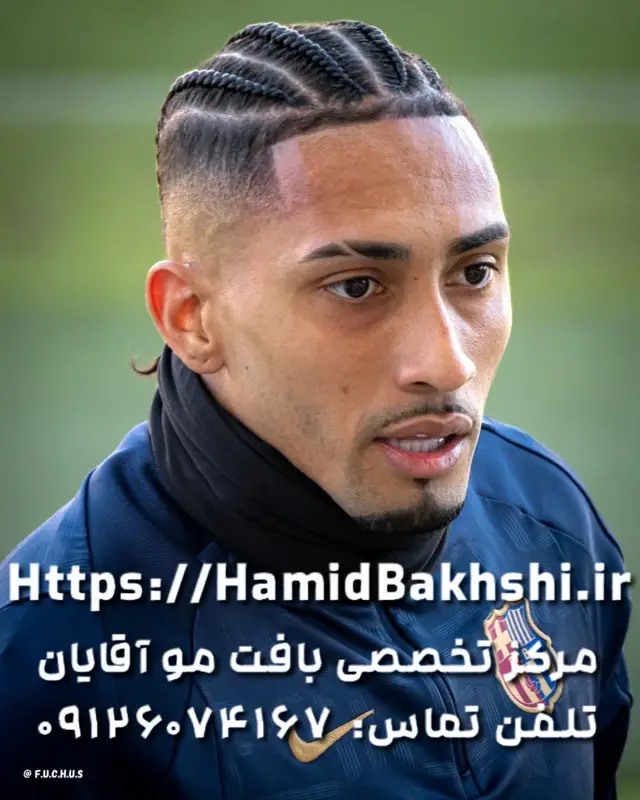 بافت مو رافینیا