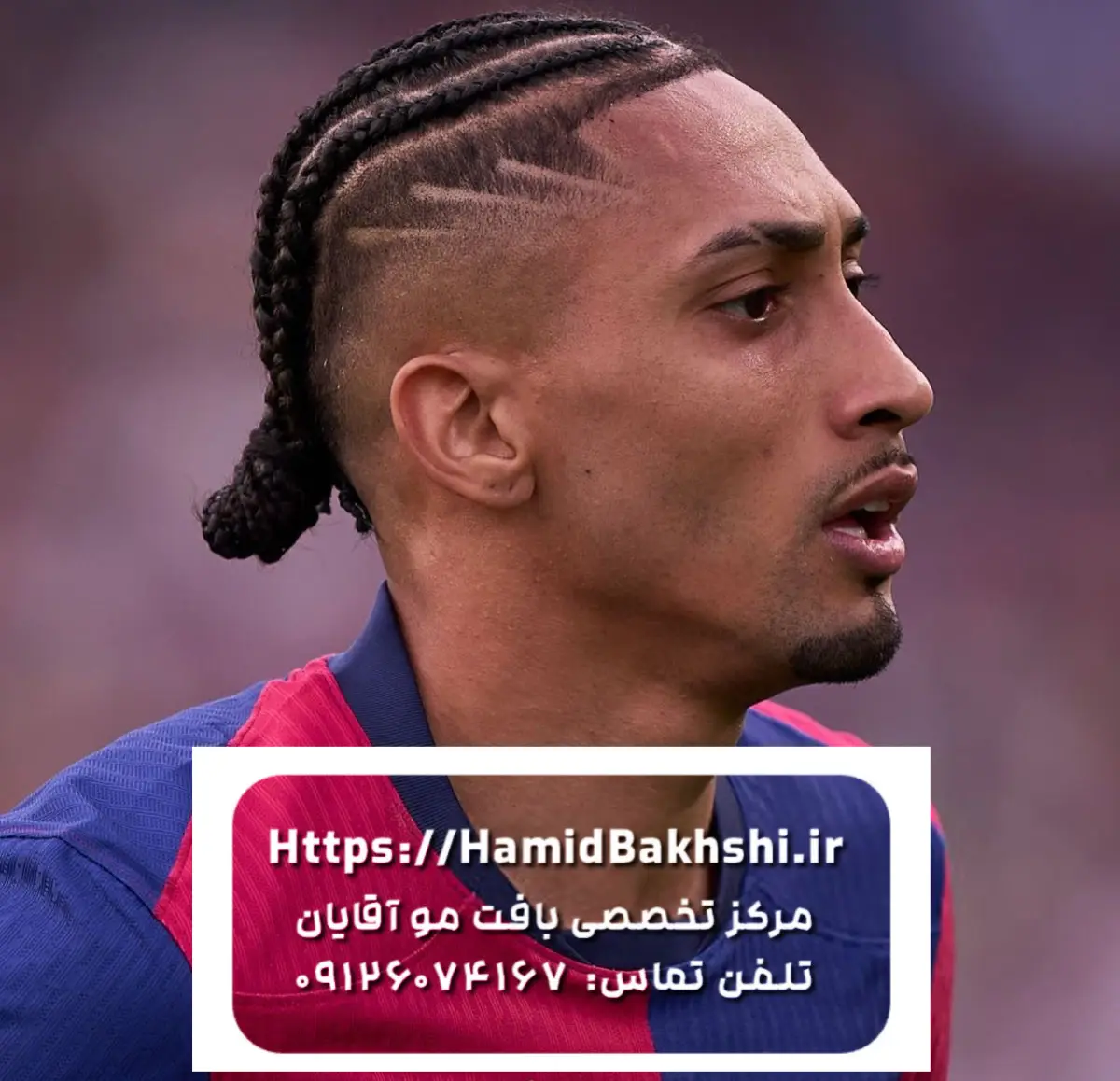 بافت مو مردانه رافینیا