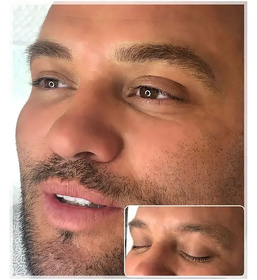 فیبروز ابرو مردانه