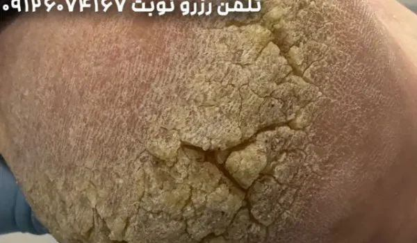 کفسابی پا