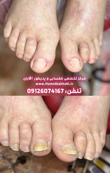 مرکز تخصصی پدیکور مردانه