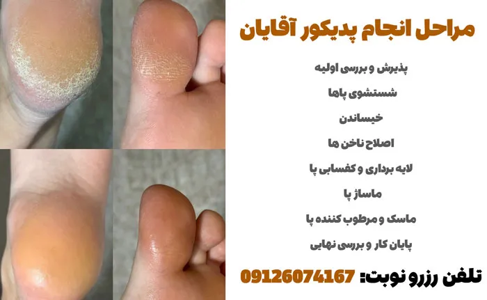 مراحل انجام پدیکور مردانه