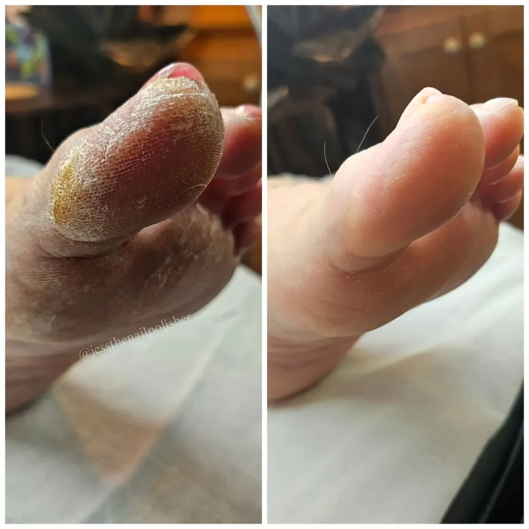 عکس و قبل پدیکور و کفسابی پا مردانه