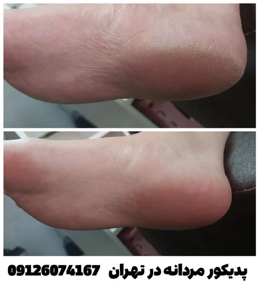 کفسابی پا مردانه در پدیکور آقایان