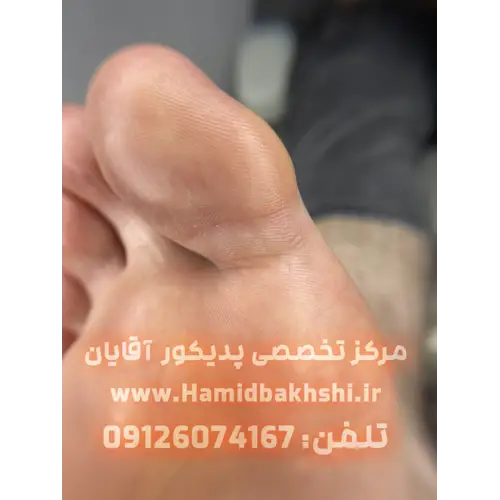 کفسابی پا مردانه در قیطریه