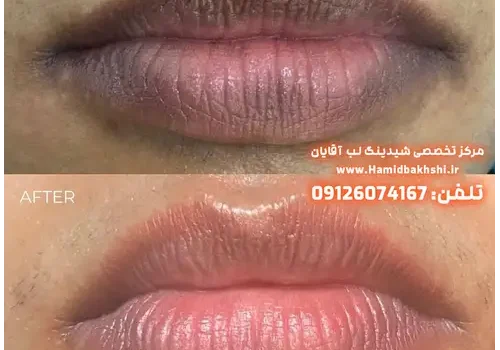 یکدست‌کردن رنگ لب آقایان