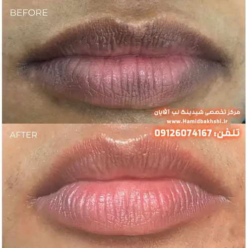 یکدست‌کردن رنگ لب آقایان