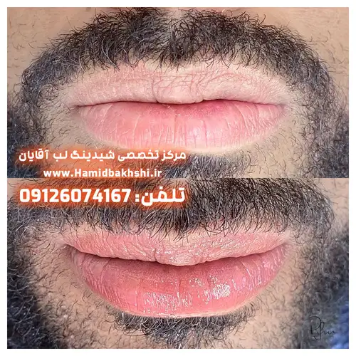 یکدست‌کردن رنگ لب آقایان