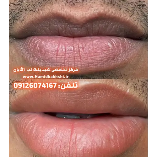 شیدینگ لب مردانه برای بازسازی رنگ لب آقایان
