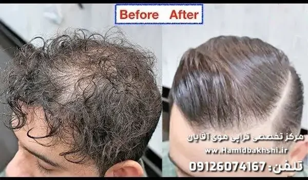 کراتینه برای صافی موی خشک آقایان در تهران