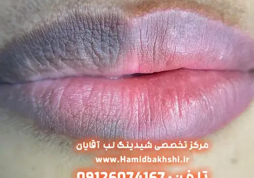 شیدینگ لب برای درمان تیرگی لب آقایان