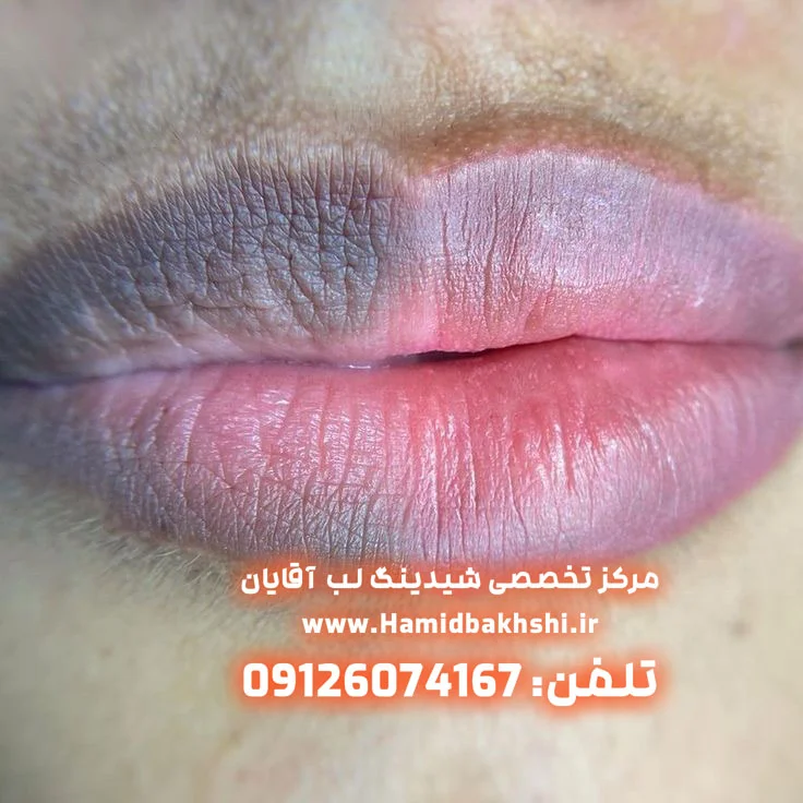 شیدینگ لب آقایان برای بازسازی رنگ لب مردانه