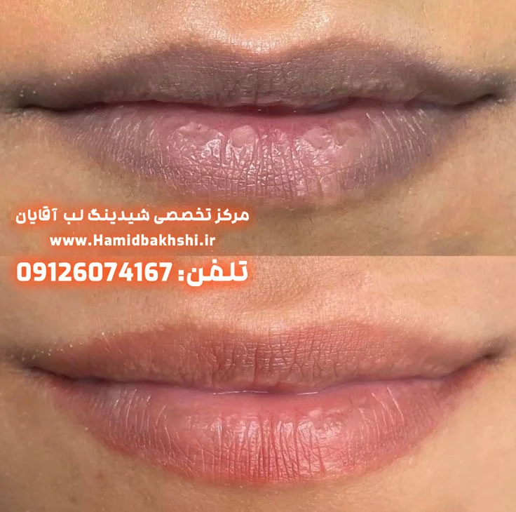 شیدینگ لب مردانه برای بازسازی رنگ لب آقایان