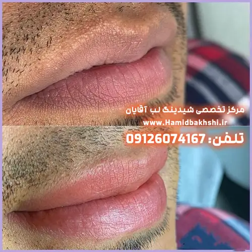 از بین بردن رنگ‌پریدگی لب آقایان